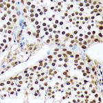 PRP19 Antibody in Immunohistochemistry (Paraffin) (IHC (P))