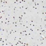 PRP19 Antibody in Immunohistochemistry (Paraffin) (IHC (P))