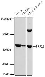 PRP19 Antibody in Western Blot (WB)