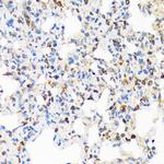 TIRAP Antibody in Immunohistochemistry (Paraffin) (IHC (P))