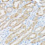 TIRAP Antibody in Immunohistochemistry (Paraffin) (IHC (P))