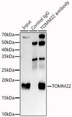 TOMM22 Antibody in Immunoprecipitation (IP)