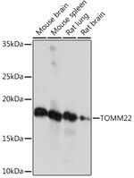 TOMM22 Antibody in Western Blot (WB)