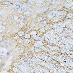 GLAST Antibody in Immunohistochemistry (Paraffin) (IHC (P))