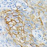 GluR6 Antibody in Immunohistochemistry (Paraffin) (IHC (P))