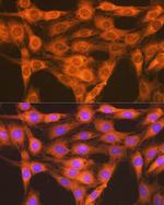 RAP1A/RAP1B Antibody in Immunocytochemistry (ICC/IF)