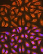 RAP1A/RAP1B Antibody in Immunocytochemistry (ICC/IF)