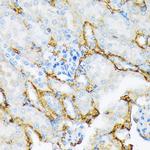 A2M Antibody in Immunohistochemistry (Paraffin) (IHC (P))