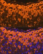 A2M Antibody in Immunohistochemistry (Paraffin) (IHC (P))