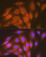 ACVRL1 Antibody in Immunocytochemistry (ICC/IF)