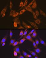 ACVRL1 Antibody in Immunocytochemistry (ICC/IF)