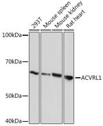 ACVRL1 Antibody in Western Blot (WB)