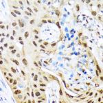 HES5 Antibody in Immunohistochemistry (Paraffin) (IHC (P))