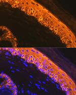 Cytokeratin 1 Antibody in Immunohistochemistry (Paraffin) (IHC (P))