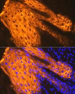 Cytokeratin 1 Antibody in Immunohistochemistry (Paraffin) (IHC (P))