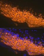 Cytokeratin 1 Antibody in Immunohistochemistry (Paraffin) (IHC (P))