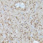 alpha Tubulin Antibody in Immunohistochemistry (Paraffin) (IHC (P))