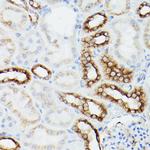 alpha Tubulin Antibody in Immunohistochemistry (Paraffin) (IHC (P))