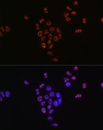 Phospho-p70 S6 Kinase (Thr421) Antibody in Immunocytochemistry (ICC/IF)