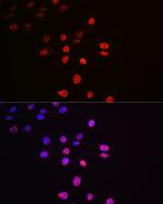 Phospho-p70 S6 Kinase (Thr421) Antibody in Immunocytochemistry (ICC/IF)