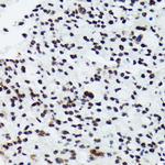 Phospho-p70 S6 Kinase (Thr421) Antibody in Immunohistochemistry (Paraffin) (IHC (P))