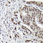 Phospho-SMAD3 (Ser423) Antibody in Immunohistochemistry (Paraffin) (IHC (P))