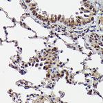 Phospho-SMAD3 (Ser423) Antibody in Immunohistochemistry (Paraffin) (IHC (P))