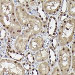 Phospho-SMAD3 (Ser423) Antibody in Immunohistochemistry (Paraffin) (IHC (P))