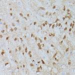 Phospho-ERK1/2 (Thr202, Tyr204) Antibody in Immunohistochemistry (Paraffin) (IHC (P))