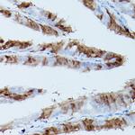 Phospho-ERK1/2 (Thr202, Tyr204) Antibody in Immunohistochemistry (Paraffin) (IHC (P))