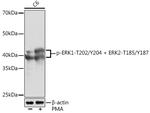 Phospho-ERK1/2 (Thr202, Tyr204) Antibody in Western Blot (WB)