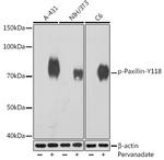 Phospho-Paxillin (Tyr118) Antibody in Western Blot (WB)