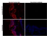 Cytokeratin 14 Antibody in Immunohistochemistry (Paraffin) (IHC (P))