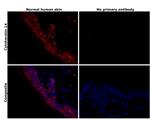 Cytokeratin 14 Antibody in Immunohistochemistry (Paraffin) (IHC (P))