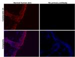 Cytokeratin 14 Antibody in Immunohistochemistry (Paraffin) (IHC (P))