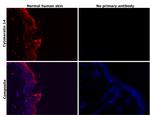 Cytokeratin 14 Antibody in Immunohistochemistry (Paraffin) (IHC (P))