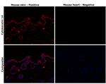 Cytokeratin 14 Antibody in Immunohistochemistry (Paraffin) (IHC (P))