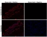 Cytokeratin 14 Antibody in Immunohistochemistry (Paraffin) (IHC (P))