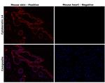 Cytokeratin 14 Antibody