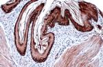 Cytokeratin 14 Antibody in Immunohistochemistry (Paraffin) (IHC (P))