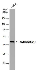 Cytokeratin 14 Antibody in Western Blot (WB)