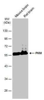 PKM Antibody in Western Blot (WB)