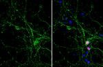 PGP9.5 Antibody in Immunocytochemistry (ICC/IF)