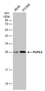 PGP9.5 Antibody in Western Blot (WB)