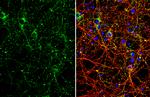 VAMP2 Antibody in Immunocytochemistry (ICC/IF)