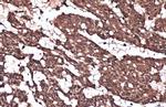 IKK beta Antibody in Immunohistochemistry (Paraffin) (IHC (P))