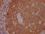 PKM Antibody in Immunohistochemistry (Paraffin) (IHC (P))