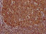 PKM Antibody in Immunohistochemistry (Paraffin) (IHC (P))