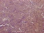 PKM Antibody in Immunohistochemistry (Paraffin) (IHC (P))