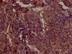 PKM Antibody in Immunohistochemistry (Paraffin) (IHC (P))